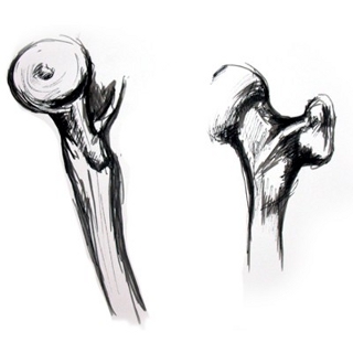 Hand-drawn anatomical sketches of the femur showing two views of the upper thigh bone, with visible contours of the femoral head, neck, and joint; shaded lines emphasize structure and form.