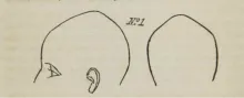 illustration of farnham's cranial outlines
